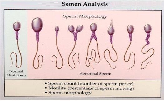 Azospermia less sperm Homeopathic Treatm photo image